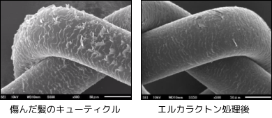 エルカラクトン処理の電子顕微鏡写真
